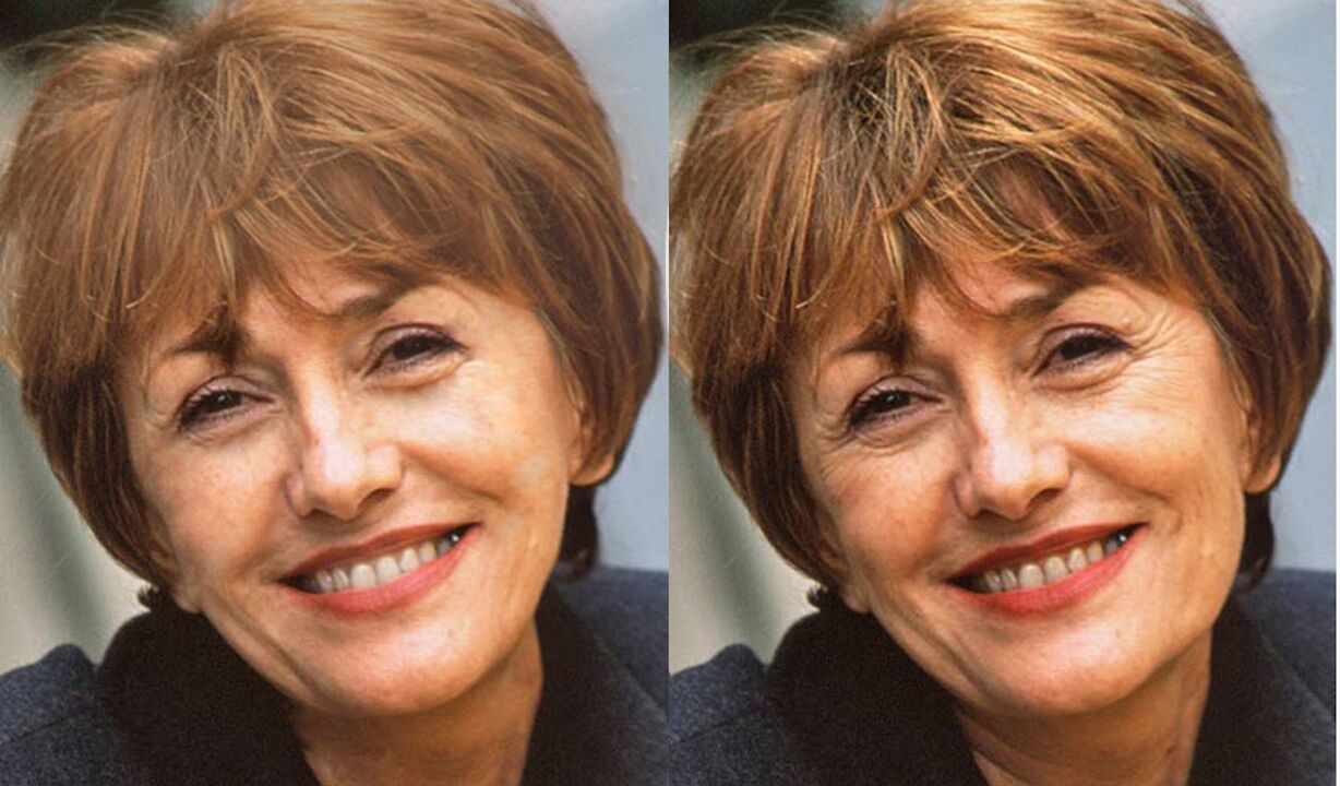 photo de visage avant et après contour